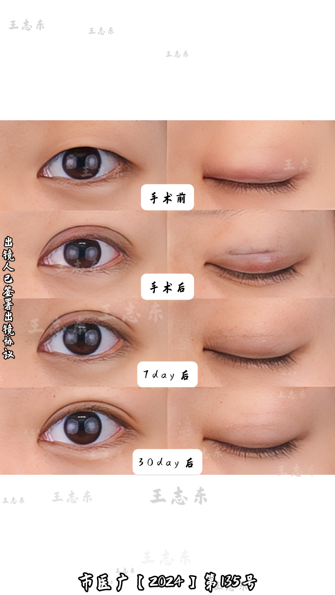 1110试验样品2.png
