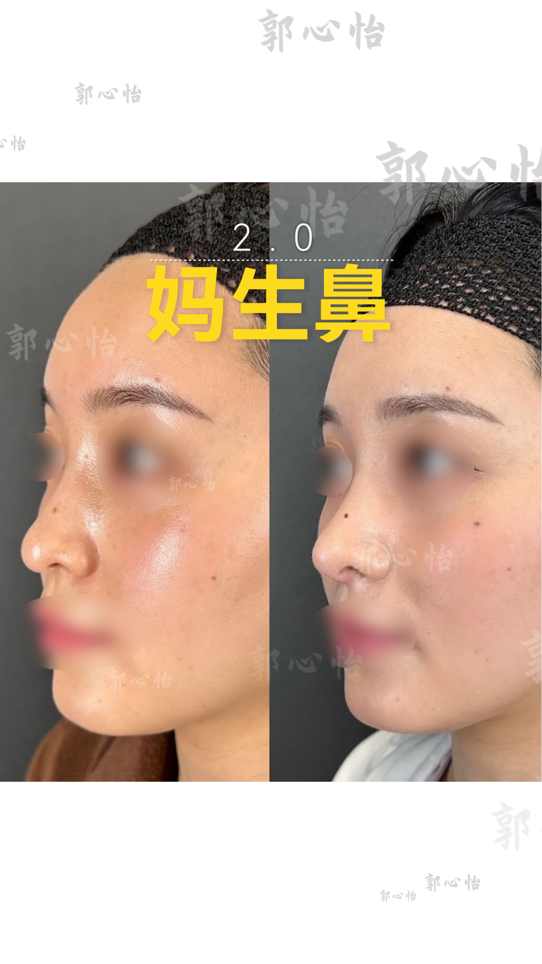 12.26鼻子11.png