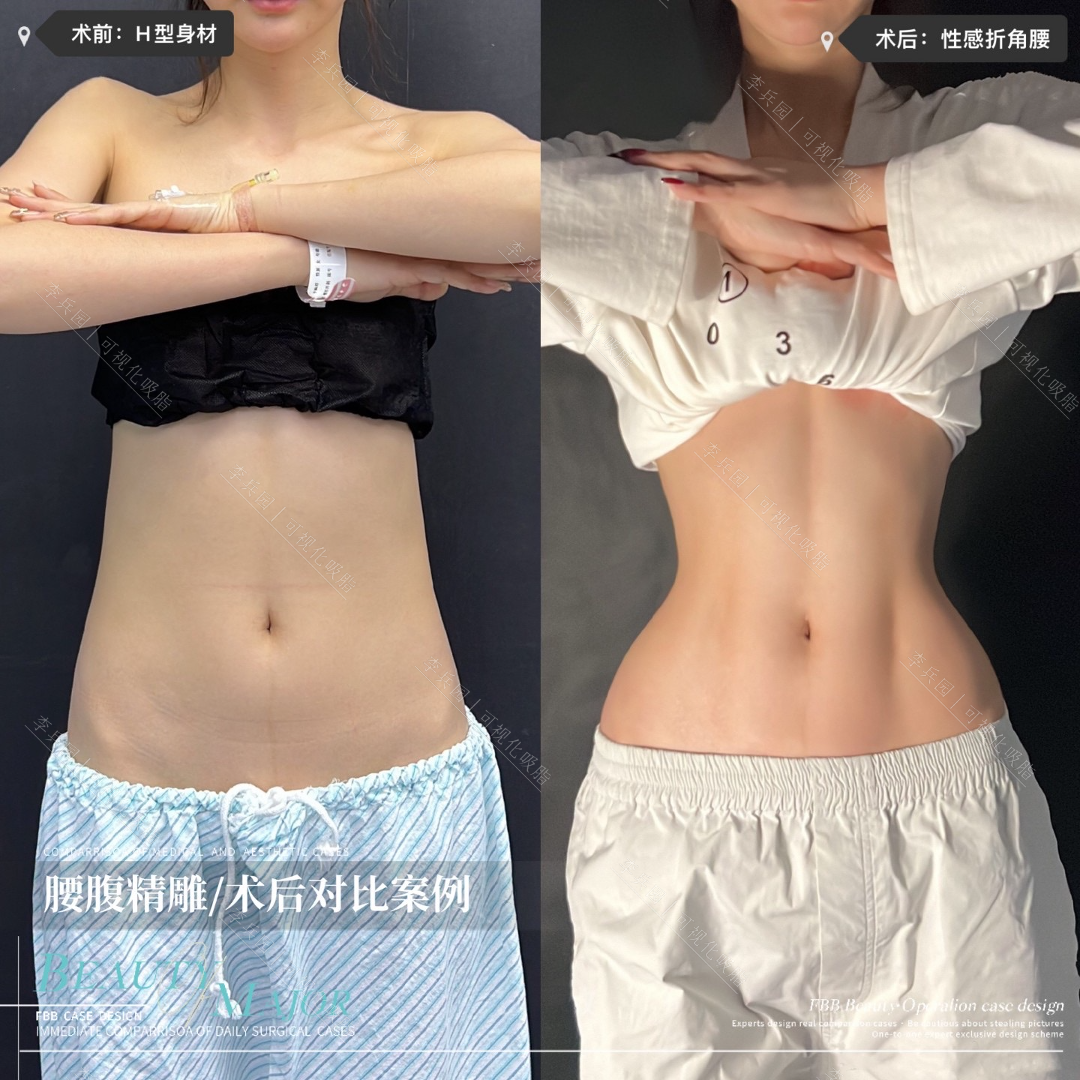 3.26图2.3.png