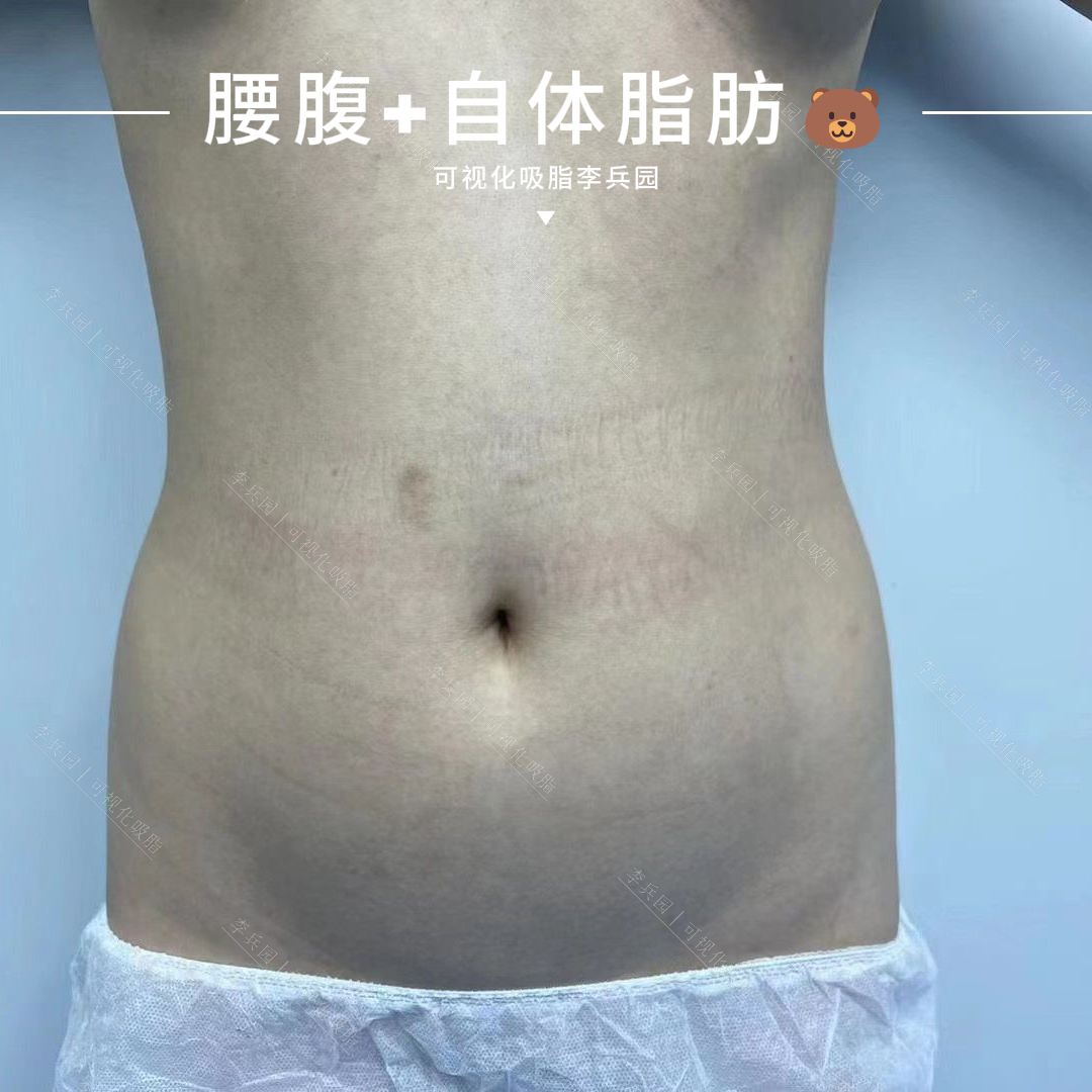 3.26图5.1.png