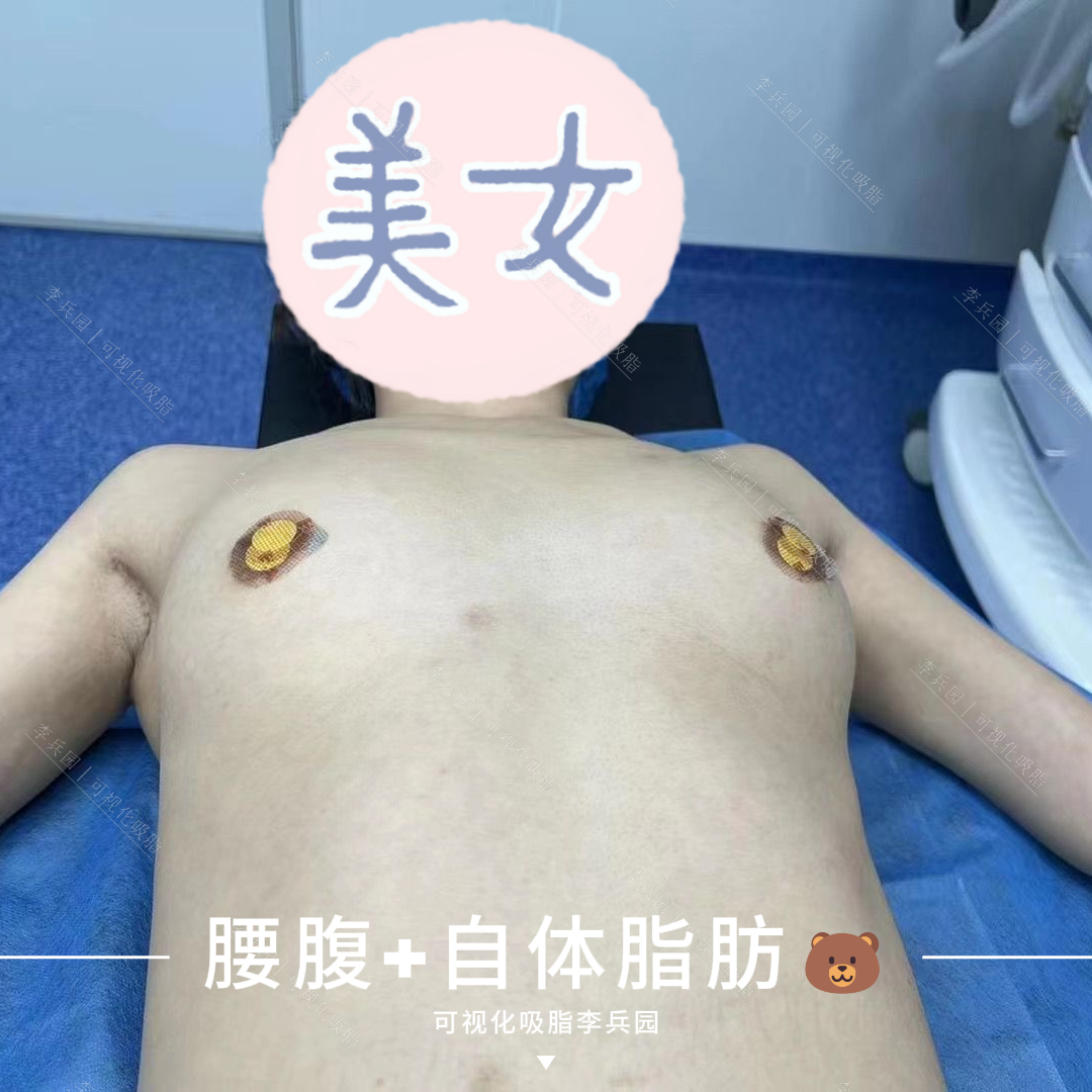 3.26图55.2.png